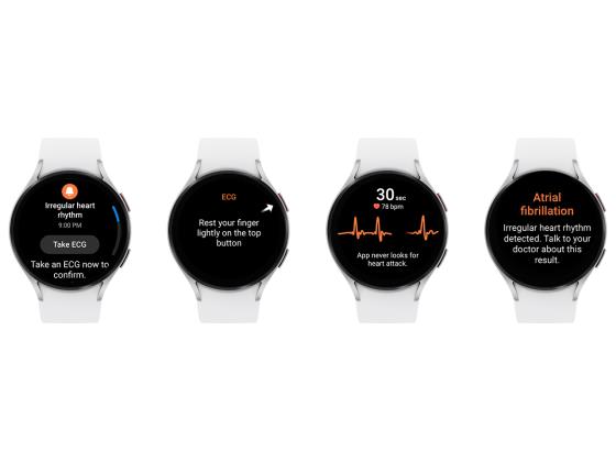 FDA одобряет: Galaxy Watch следит за вашим сердечным ритмом и предотвращает опасность